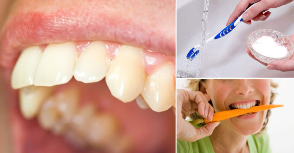 Стоматологи вам не розкажуть: є цілих 12 способів зняти зубний біль